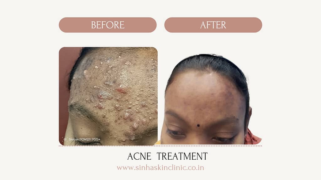 Brown and Beige Beauty Before After Cosmetology Instagram Post Presentatio 20250618 192157 0000