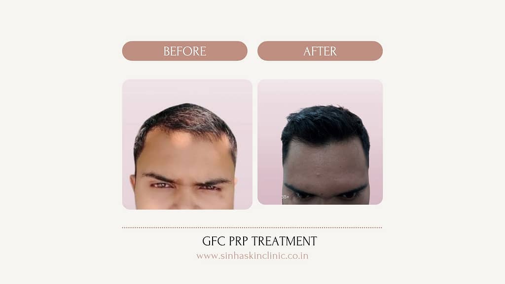 Brown and Beige Beauty Before After Cosmetology Instagram Post Presentatio 20250618 192241 0000